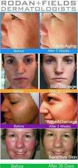 Who help me get great rod of oscar