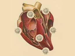The standard crp test does. What Covid 19 Does To The Heart The Atlantic