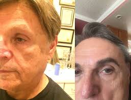 Testimonials — Ziering Medical