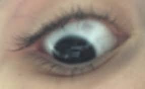 Schwarz Grauer Punkt Im Auge Augen Punkte