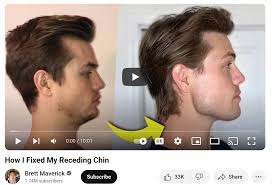 Kaugummis für einen kantigen Kiefer: effektiv oder schädlich?