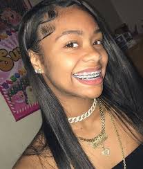 Black And Light Purple Braces Pin On Clear Skin