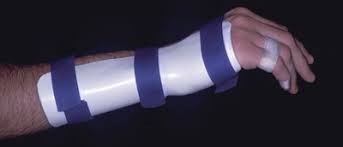 Image result for Radial Gutter Cast