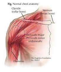 Right side abdomen muscle (external oblique muscle)got tighten it pull the right rib cage. Chest Muscle Injuries Strains And Tears Of The Pectoralis Major Hughston Clinic