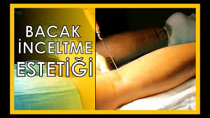 Bacak Inceltme Ameliyati Fiyatlari Op Dr Ali Mezdegi