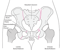 Das becken | die becken. Beckenfrakturen Verletzungen Und Vergiftung Msd Manual Ausgabe Fur Patienten