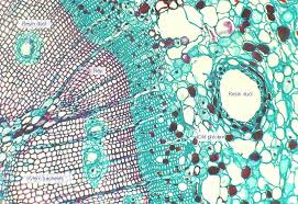 One Year Old Pine Stem Cross Section Things Under A Microscope Cross Section City Photo