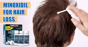 Can rogaine (minoxidil) cause transient hair loss when first used? Minoxidil For Hair Loss Secrets That No One Else Knows About Lewigs
