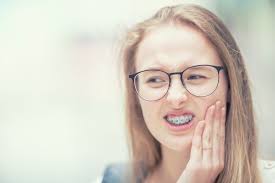 Discover now the most modern transparent aligner system and transform your smile. How To Manage Irritating Braces Wires I Song Orthodontics