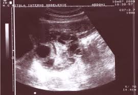 We did not find results for: Ultrasound Of Echinococcal Liver Cysts