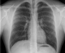 Rontgen Radiologie Am Diakonissenkrankenhaus
