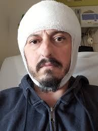 Super new to this Had a seizure few weeks ago due to encephalitis, I  haven't had a diagnosis yet but really been struggling with emotional  control, has anyone had any experience with