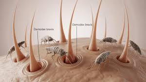 Image result for Demodex brevis