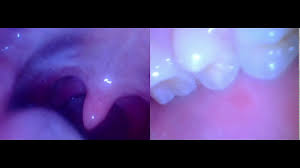 We did not find results for: Swallowing Glass Gems P1 Hd Slow Motion By Cj Gulps