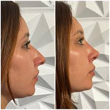 Dr.Robert Bolivar Marquez