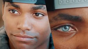 Übersicht können farbige kontaktlinsen den augen schaden? Gefahrlicher Schonheitstrend Das Sind Keine Kontaktlinsen Ihm Wurde Ins Auge Gestochen News Ausland Bild De