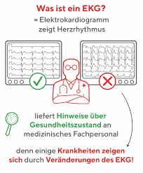 Insbesondere wenn das schwitzen von fieber begleitet wird und. Mobile Ekg Gerate Jederzeit Selbst Den Herzrhythmus Messen