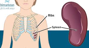 Image result for Splenomegaly