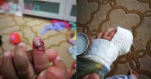 Makanya, jangan heran aja kalau nemu santri, yang kalau dirumah lalai sholatnya. Jari Anak Umur Setahun Berdarah Lepas Kena Bakul Baju Mujur Pengasuh Ambil Tindakan Cepat Rawat Cara Betul Pa Ma