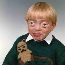 About home trending history get youtube 30.08.2018 · receding hairline and age. Fucking Ugly Asses On Twitter Lmfao Why Yall Still Like Harry Ugly Ass When His Hairline Looking Like Louis Gender