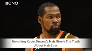 Unveiling Kevin Durant's Hair Story: The Truth About Hair Loss