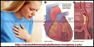 Sakit dada sebelah kiri ! Obat Sakit Dada Sebelah Kanan Atasi Sakit Dada Sebelah Kanan Secara Efektif