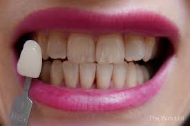 White light teeth whitening malaysia has 116 employees and is ranked 3rd among it's top 10 competitors. Spa Beauty Treatments Kl 2018 Top Seven The Yum List