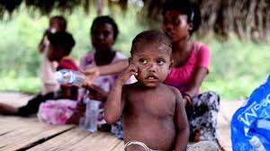 Penolong pegawai pembangunan jabatan kemajuan orang asli (jakoa) gua musang, muhamad yusrizal ghani berkata, jakoa memperuntukkan hampir rm800,000 untuk menyalurkan bekalan makanan kepada. Kuala Koh Orang Asli Dying From Measles Outbreak