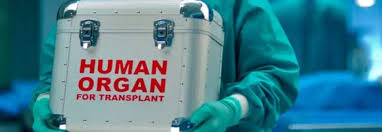 Image result for Transplantation