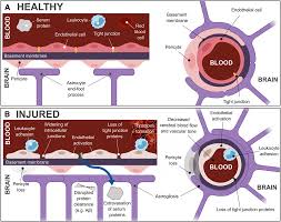 Cerebral Microvascular Injury A Potentially Treatable