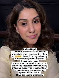 You all know I'm quite open where it comes to things like health and the  ageing process so I have noticed all of a sudden these little puffy bags  that appear under