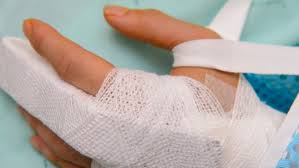 Use the thumb and fingers of your good hand to grasp below the middle joint of your affected finger. Jammed Finger Vs Broken Finger How To Tell The Difference The Emergency Clinic