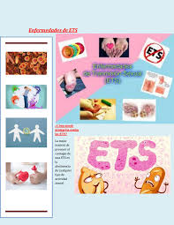 Enfermedades De Transmision Sexual By Enerolizamora Issuu