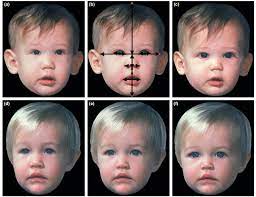 Ncbi Rofl What Makes A Cute Baby Cute Discover Magazine