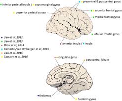 Image result for Cerebral Subcortex