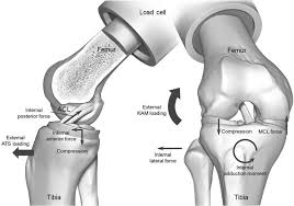 Continue to apply ice to the area for 2 to 3 days. Schematic Of Injury Mechanism Left External Loading Of Anterior Download Scientific Diagram