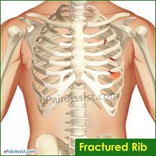 Pin On Chest Pain