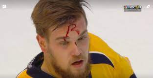 Complete player biography and stats. Viktor Arvidsson S Forehead Stamped With A Bloody R After Getting Boarded By Nick Ritchie Album On Imgur