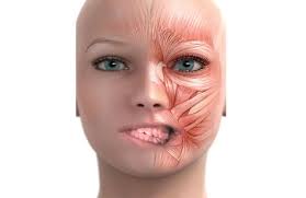 Can Physiotherapy Help Patients with Herniated Discs/PLID in the Lower  Back? An Evidence-Based Approach