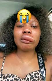 CYCLONE MADAGASCAR 2025