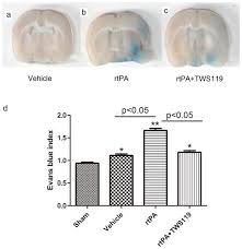 Página oficial, de radio televisión del principado asturias. Gsk 3b Inhibitor Tws119 Attenuates Rtpa Induced Hemorrhagic Transformation And Activates The Wnt B Catenin Signaling Pathway After Acute Ischemic Stroke In Rats Abstract Europe Pmc