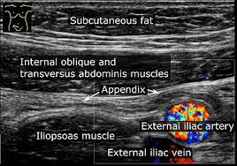 Appendix Anatomy Wikiwand