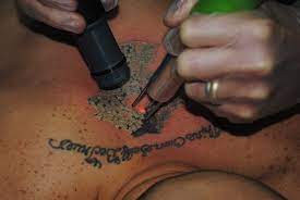 For more information, visit texas.gov and submit information through the vendor enquiry form for vendors/suppliers who may be able to offer products to the state. Laser Tattoo Removal Training Course Info New Look Laser College