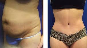 Pin On Plastic Surgery
