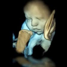 Alles zur entwicklung des babys in ihrem bauch, ultraschall, herzschlag, symptomen und anzeichen sowie videos… 3d 4d Ultraschall Fotogalerie