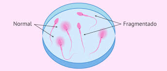 Como Saber Si Soy Esteril Pruebas De Fertilidad En El Hombre