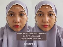 Review] SKINTIFIC 5X Ceramide Barrier Repair Moisture Gel, Pelembab Untuk  Memperbaiki Skin Barrier