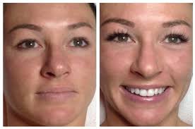 Image Result For Full Face Eyelash Extensions Before And After Eyelash Extensions Before And After Eyelash Extensions Permanent Eyebrows