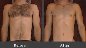 Stomach hair can be embarrassing for both men and women. Manscape Chest Stomach Arms Arm Pits Youtube