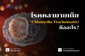 Image result for Chlamydia Trachomatis